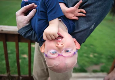 PATH TO TREATMENT: Marley, pictured here with her father, was diagnosed with the rare genetic condition Bachmann-Bupp syndrome a few years ago.